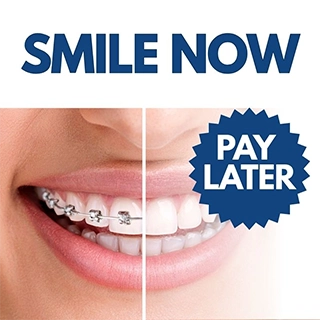 Offer $99 Braces