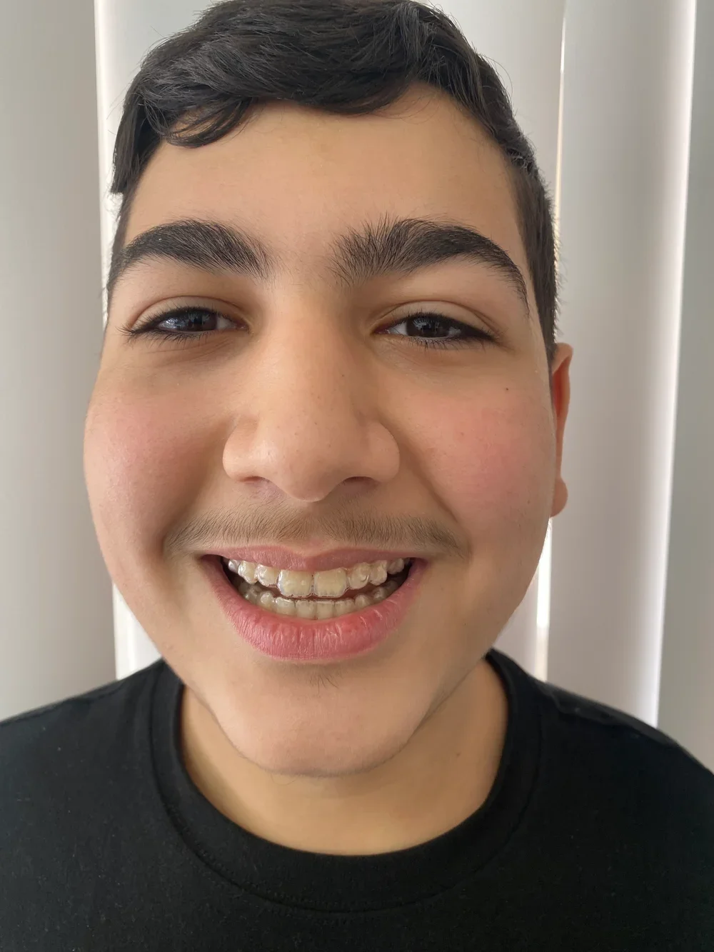 Balboa Dentistry patient smiling.