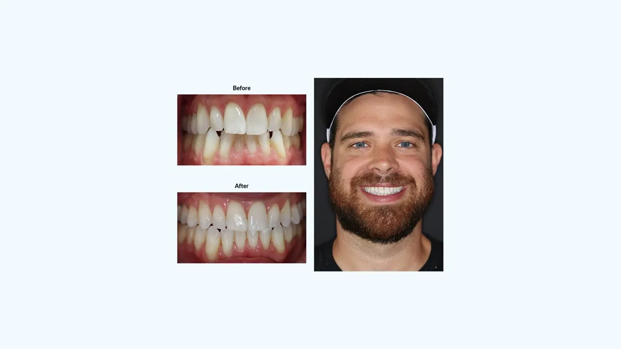 Smile gallery case 2