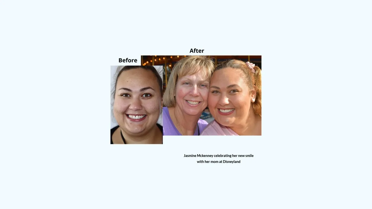 Smile gallery case 7