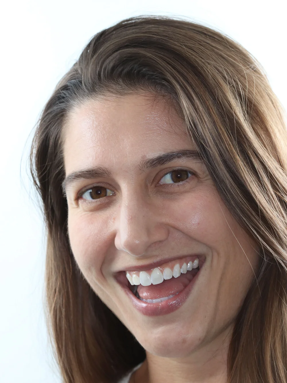 Woman smiling in the Balboa Dentistry smile gallery.