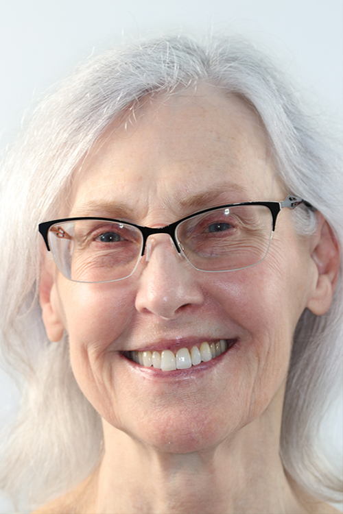 Woman showing a beautiful smile after cosmetic dental care in San Diego.